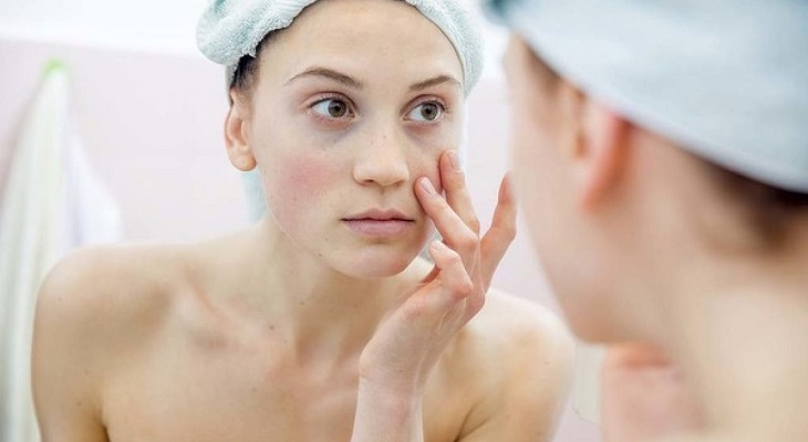 Cách chữa ngứa da mặt tại nhà đơn giản và hiệu quả là gì?