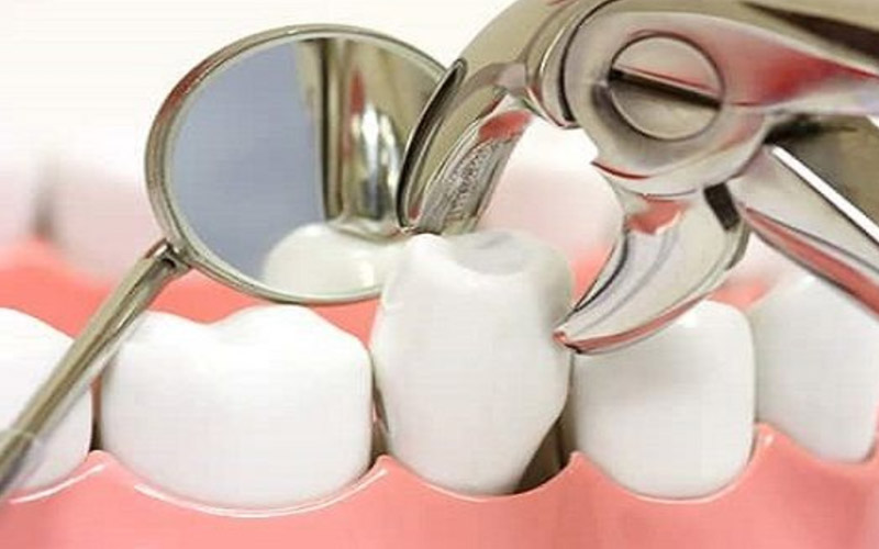 Nếu chọn các sản phẩm kém chất lượng răng sẽ có tuổi thọ sử dụng không cao