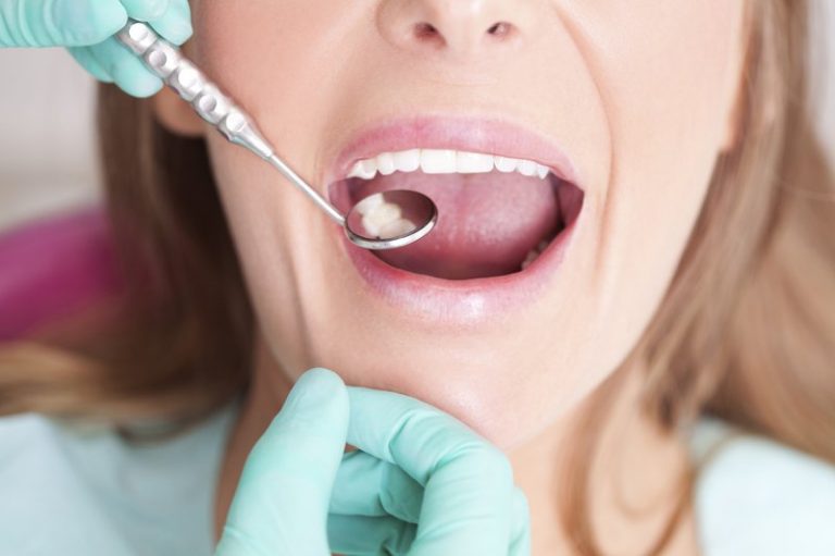 Trường hợp bị bệnh lý răng miệng cần phải điều trị trước khi niềng răng