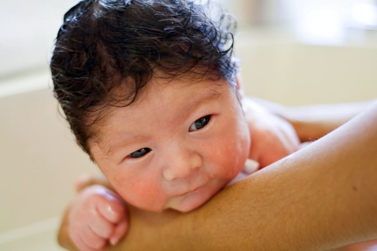 Trẻ sơ sinh bị viêm da có mủ là bệnh gì