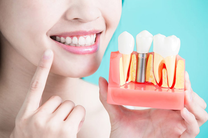 Sau khi trồng răng implant có đau không?