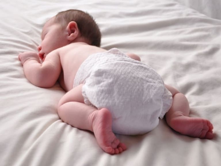 Thói quen sử dụng bỉm cho bé quá nhiều giờ trong ngày khiến bé bị viêm da vùng bẹn, mông