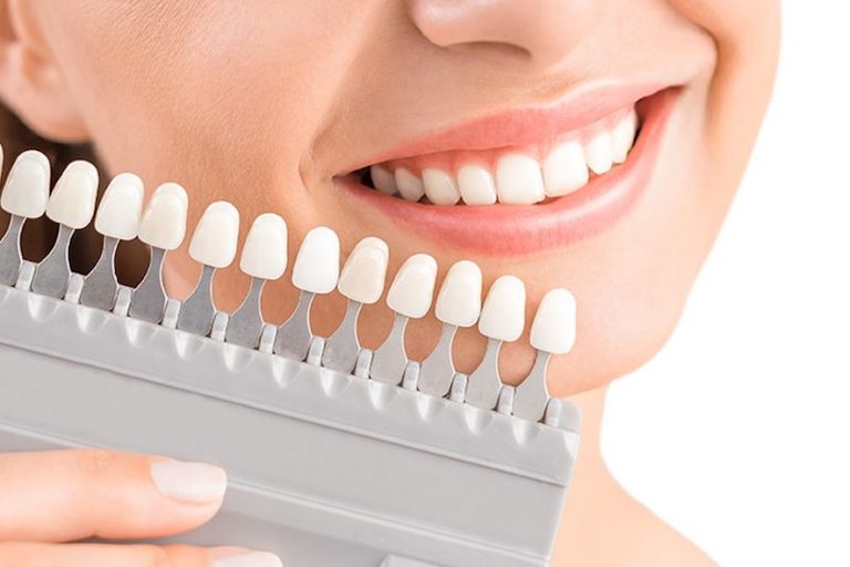 Bọc răng sứ sẽ đem tới tính thẩm mỹ cao, đảm bảo khả năng ăn nhai